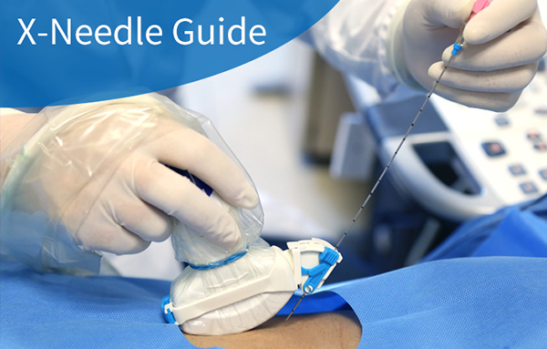 New Release of Disposable X-Needle Guide V3.0